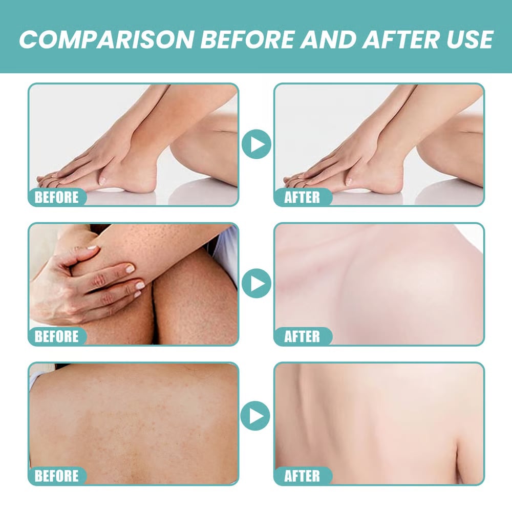 2026 Nyhed-✨ Skin So Soft Original Bath Oil – Silkeblød hud & naturlig beskyttelse mod fluer og myg til mennesker og kæledyr 🛁🐴