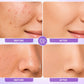 💜Perfect hudtone – hurtigvirkende matterende creme