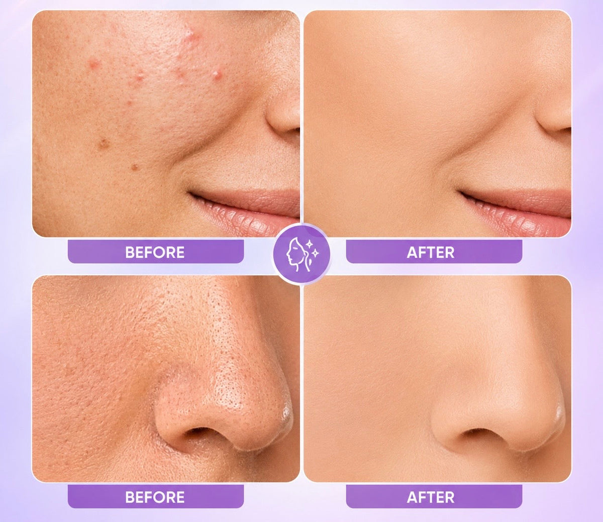 💜Perfect hudtone – hurtigvirkende matterende creme