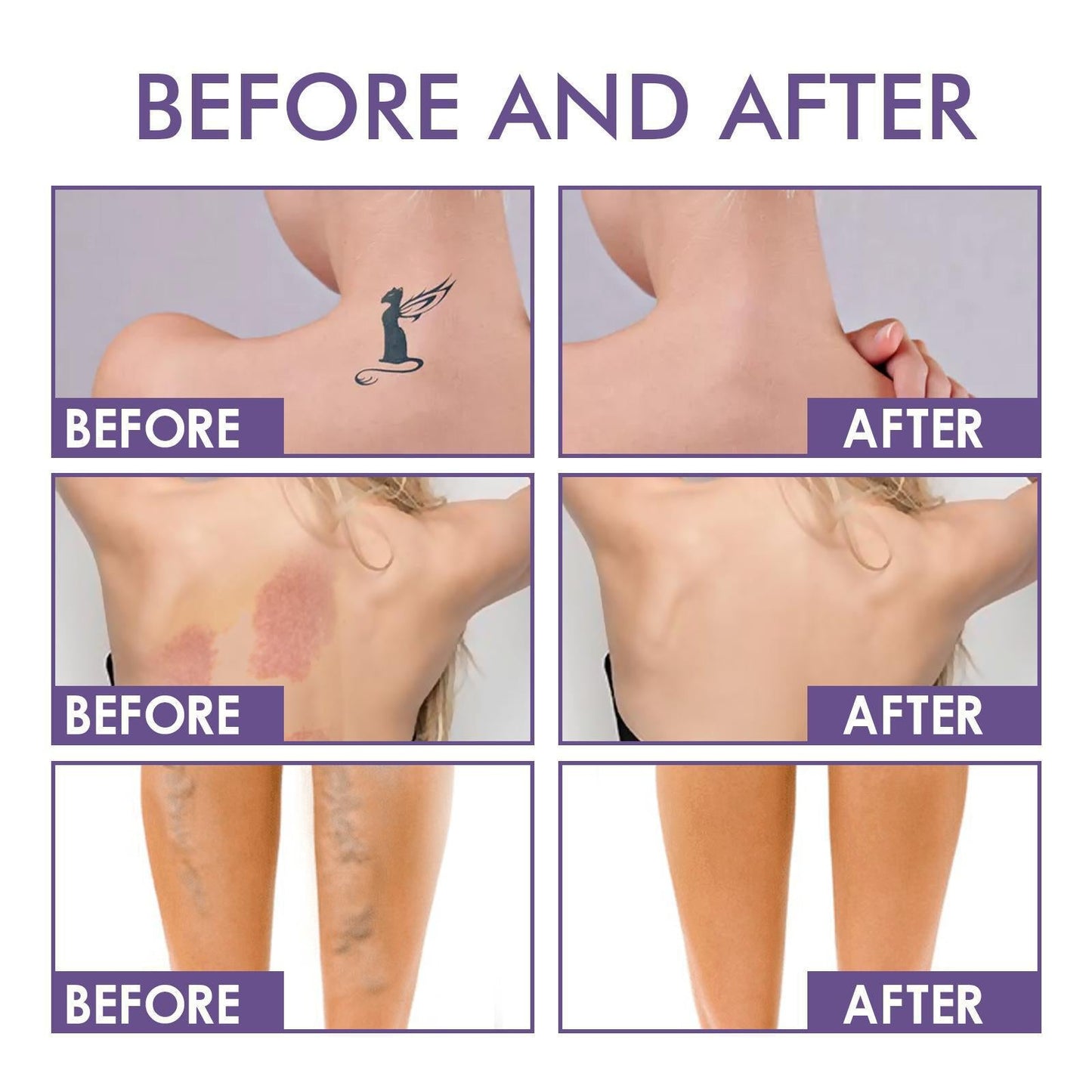 💜 Sidste dag: Køb 1, få 1 gratis! 💜✨ Body Coverage Perfector – vandfast, let og fejlfri kropsmakeup
