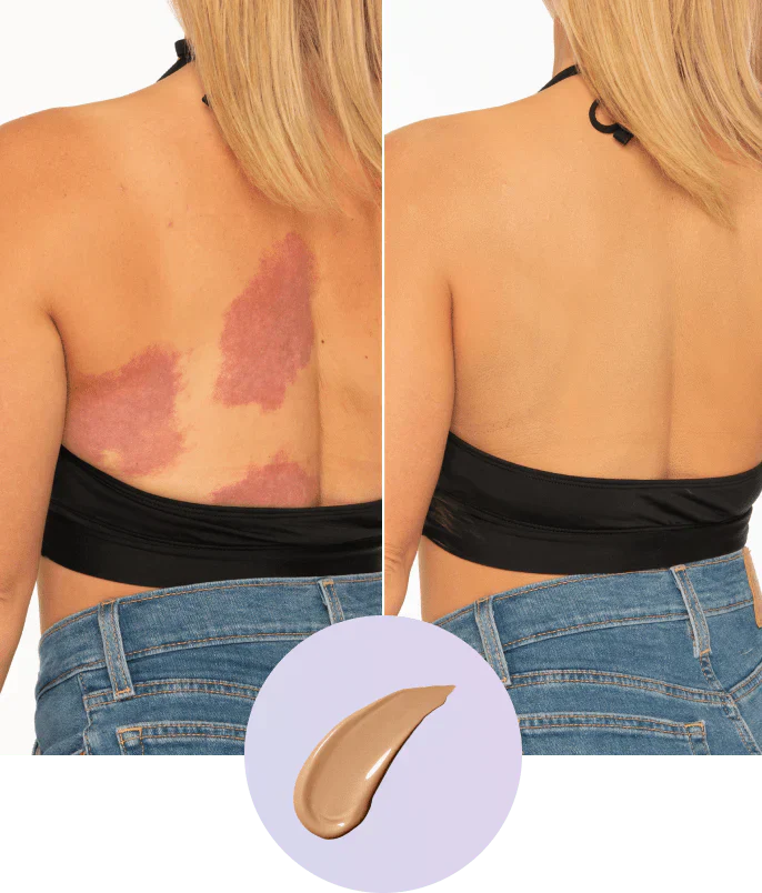 💜 Sidste dag: Køb 1, få 1 gratis! 💜✨ Body Coverage Perfector – vandfast, let og fejlfri kropsmakeup