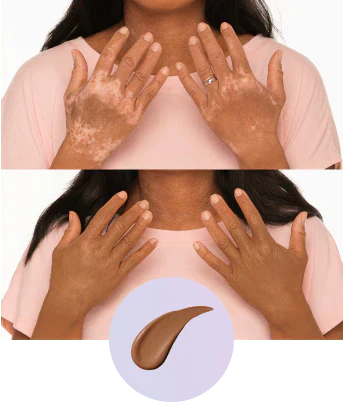 💜 Sidste dag: Køb 1, få 1 gratis! 💜✨ Body Coverage Perfector – vandfast, let og fejlfri kropsmakeup