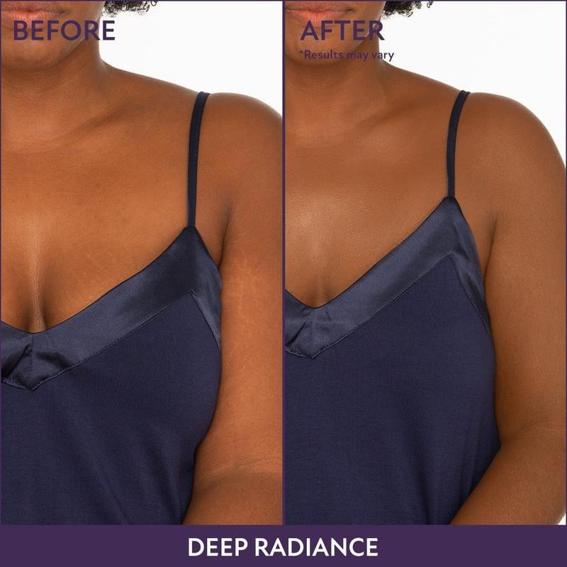 💜 Sidste dag: Køb 1, få 1 gratis! 💜✨ Body Coverage Perfector – vandfast, let og fejlfri kropsmakeup