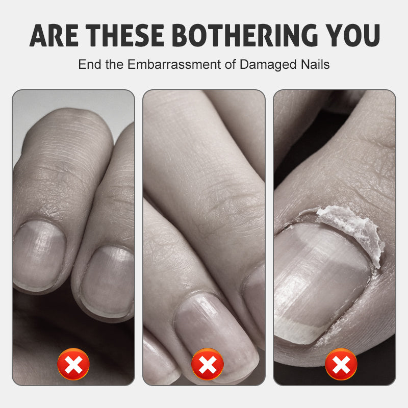 💅🧴 PROMO Nærende reparationsspray til skrøbelige negle ✨