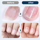 💅🧴 PROMO Nærende reparationsspray til skrøbelige negle ✨