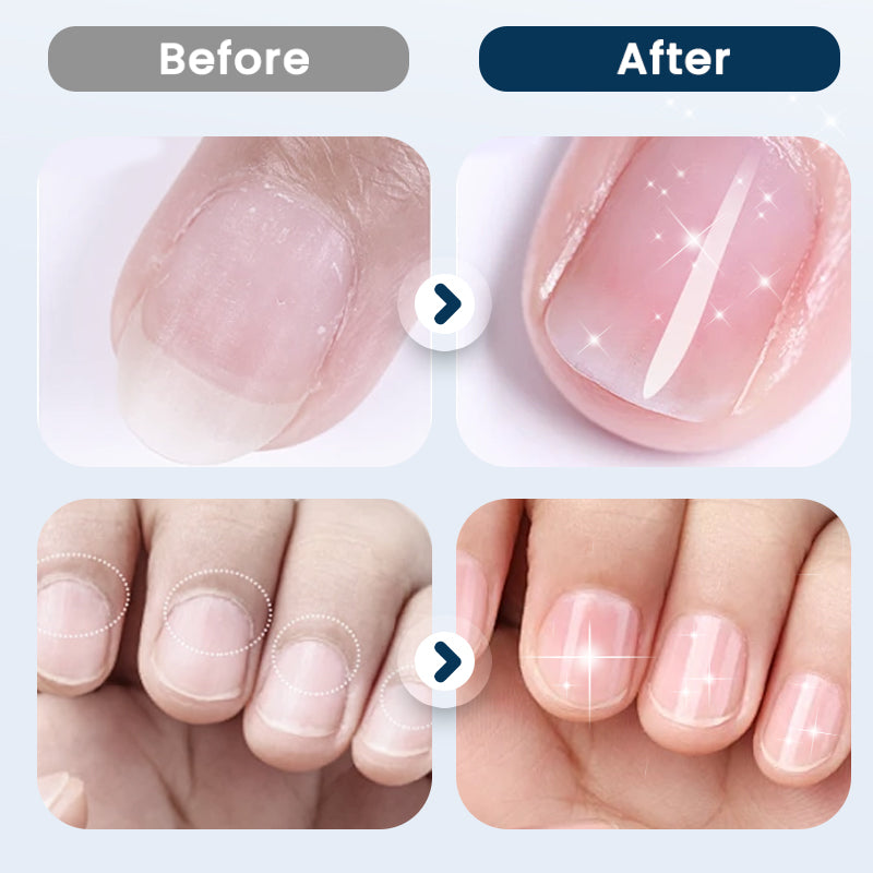 💅🧴 PROMO Nærende reparationsspray til skrøbelige negle ✨