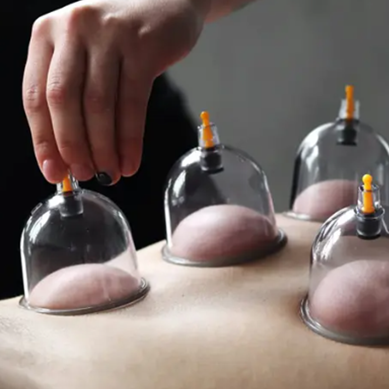 ⏳Tidsbegrænset tilbud⏰Vakuum-cuppingsæt – fortykkede kopper, sugepumpe, gennemsigtigt design 🩺