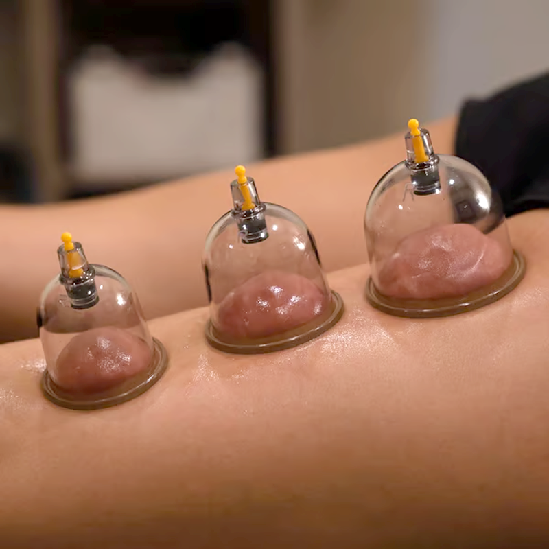 ⏳Tidsbegrænset tilbud⏰Vakuum-cuppingsæt – fortykkede kopper, sugepumpe, gennemsigtigt design 🩺