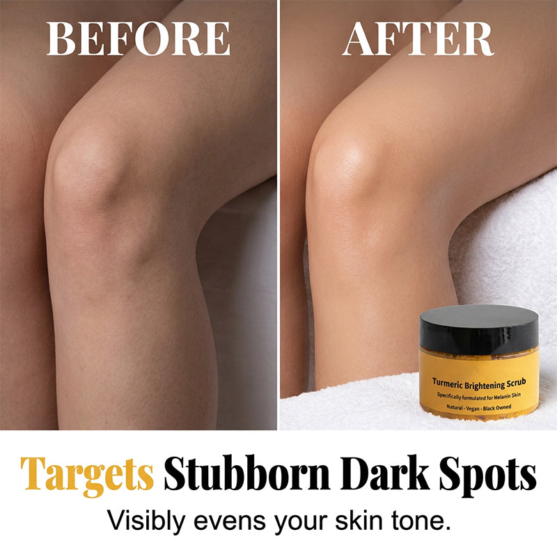 🔥KØB 2 FÅ 1 GRATIS🔥 Gurkemeje Eksfolierende Body Scrub